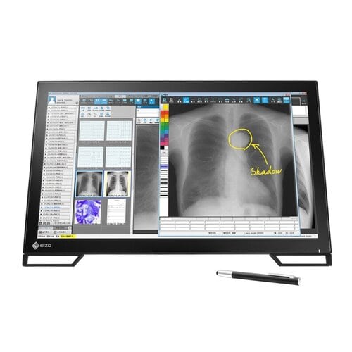 The monitor features projected capacitive (PCAP) touch technology which is more reliable compared to other touch technolog